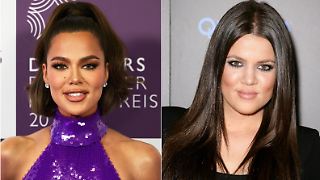 Khloé Kardashian listet alle ihre Beauty-Eingriffe auf