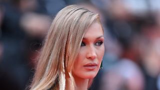 Bella Hadid schockt mit drastischen Krankenhaus-Bildern