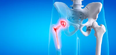 Teuer und ineffizient – das bittere Zeugnis für das deutsche System